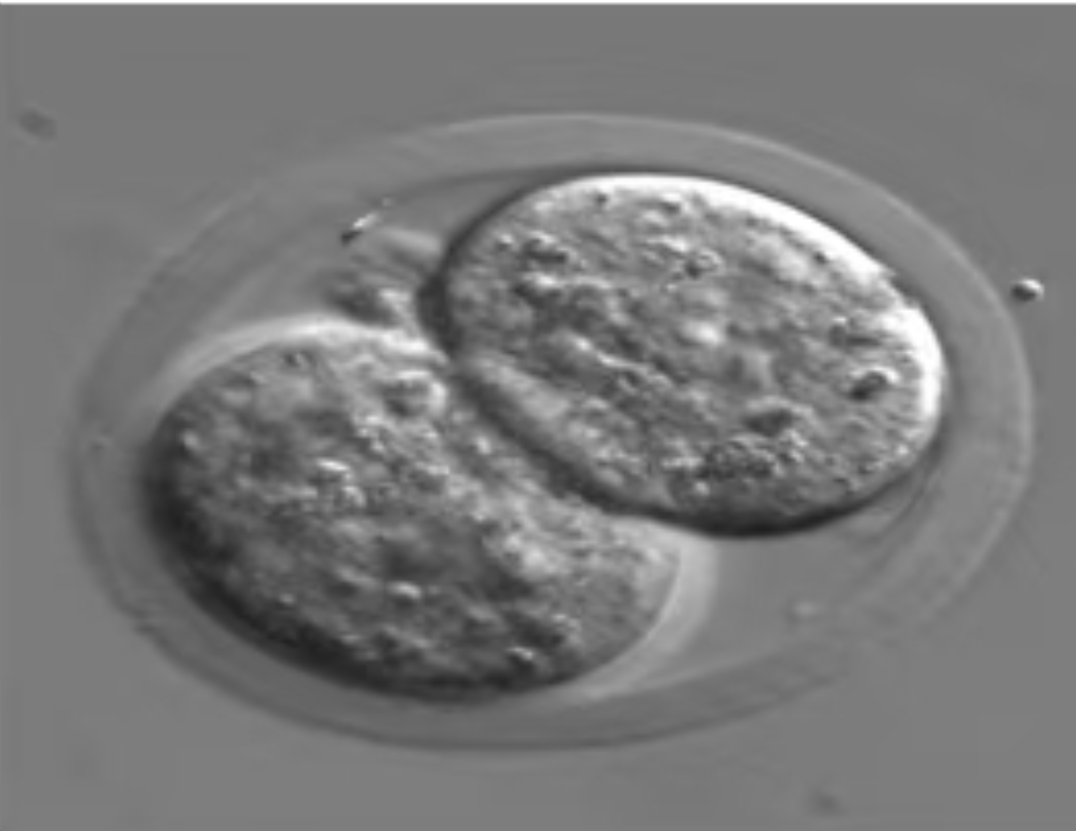 IVF-ET技术应用场景