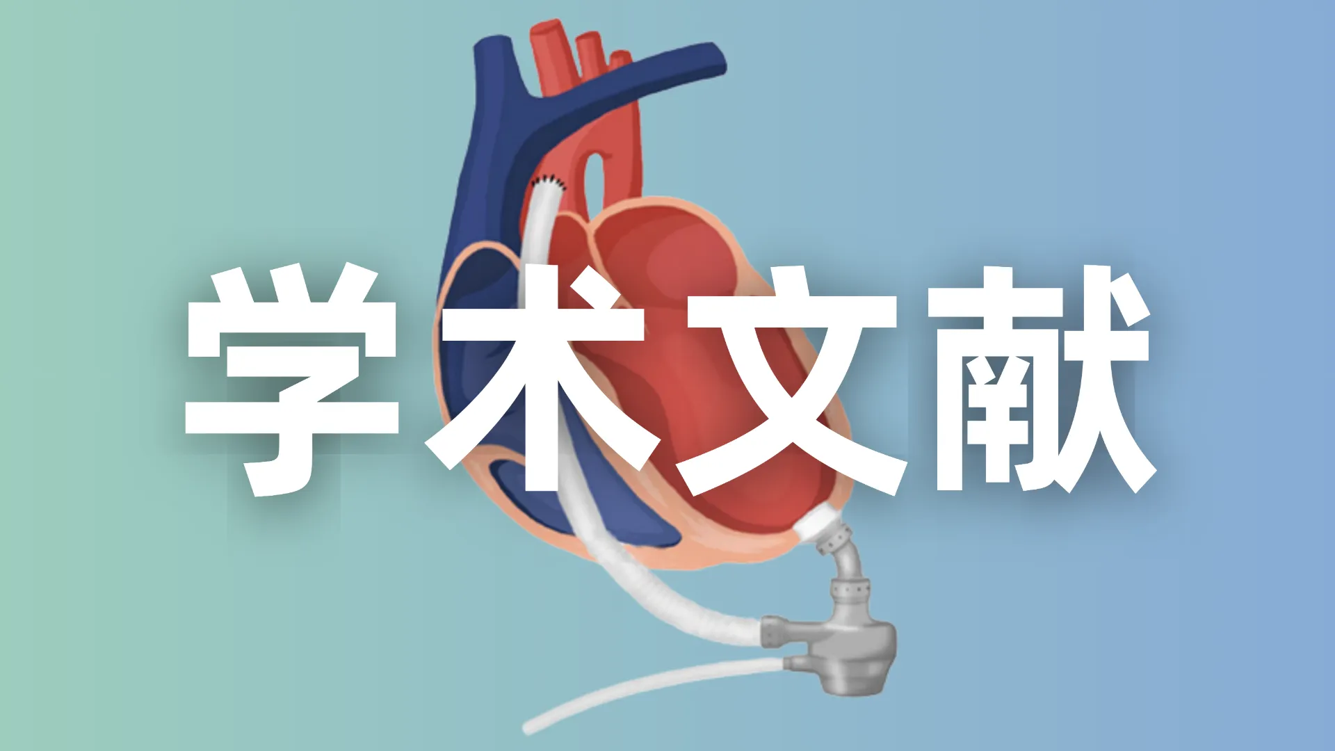 EVAHEART I全植入式心室辅助装置治疗心力衰竭长期疗效